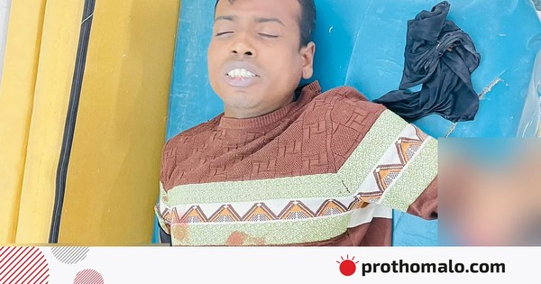 খুলনায় বাড়ি থেকে ডেকে নিয়ে যুবকের দুই হাতের কবজি কেটে দিল দুর্বৃত্তরা