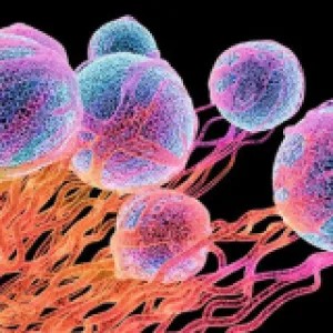 ক্যানসারের ১১টি লক্ষণ, যা আপনার জানা উচিত