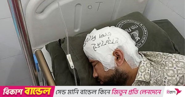 ফ্রিজে রাখা খুলি দুই মাস পর লাগানো হলো মামুনের মাথায়